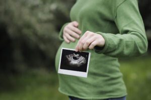 Structural Ultrasound Scans for Pregnant Women Provide a Good In side Look 